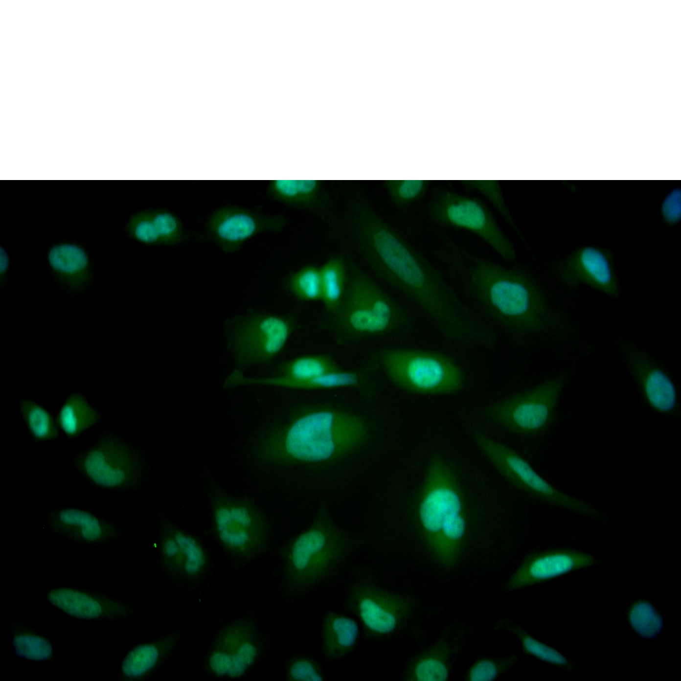 EZH2_A488_TDS_F2c_Merged_de.png
